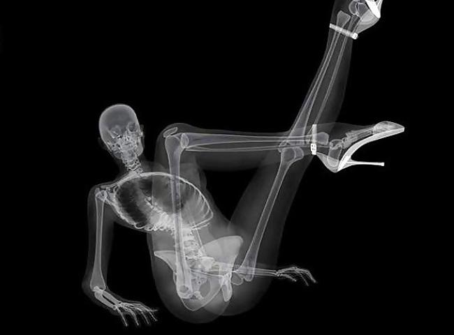 12P Very skinny chick