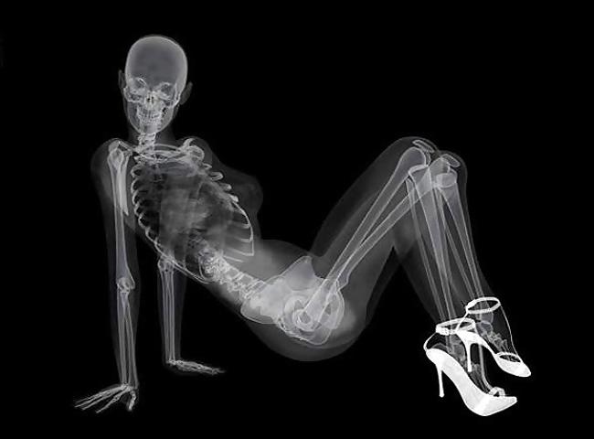 12P Very skinny chick