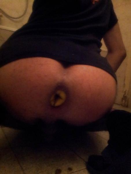 25P My gape