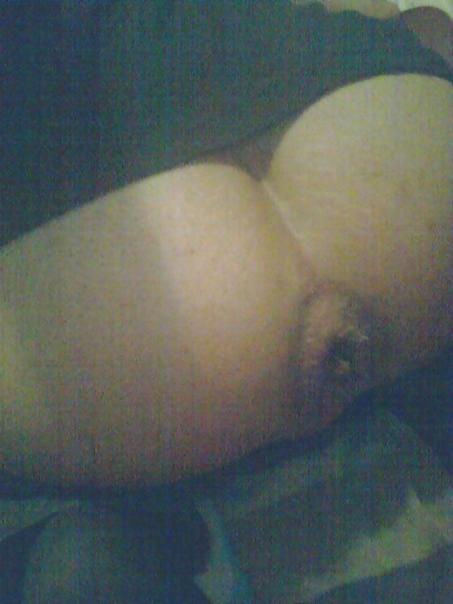 25P My gape
