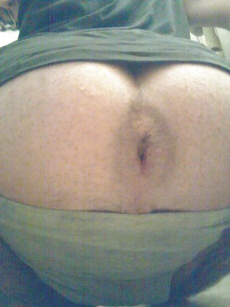 25P My gape