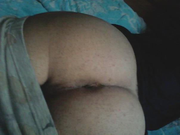25P My gape