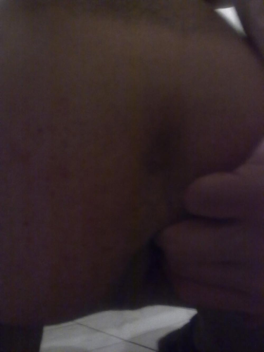 25P My gape