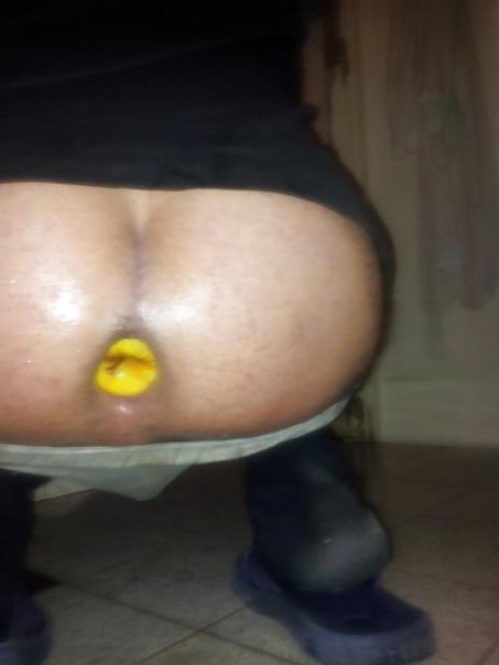 25P My gape