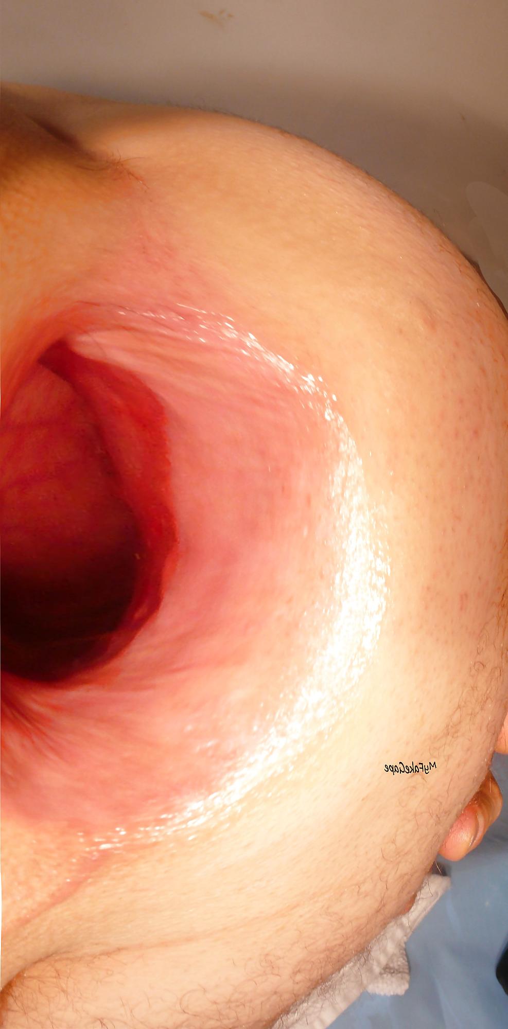 17P My FAKE GAPE 9