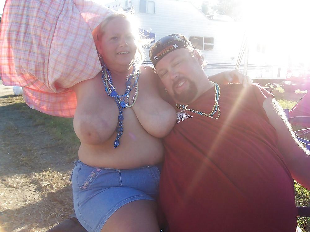 22P Fat couple