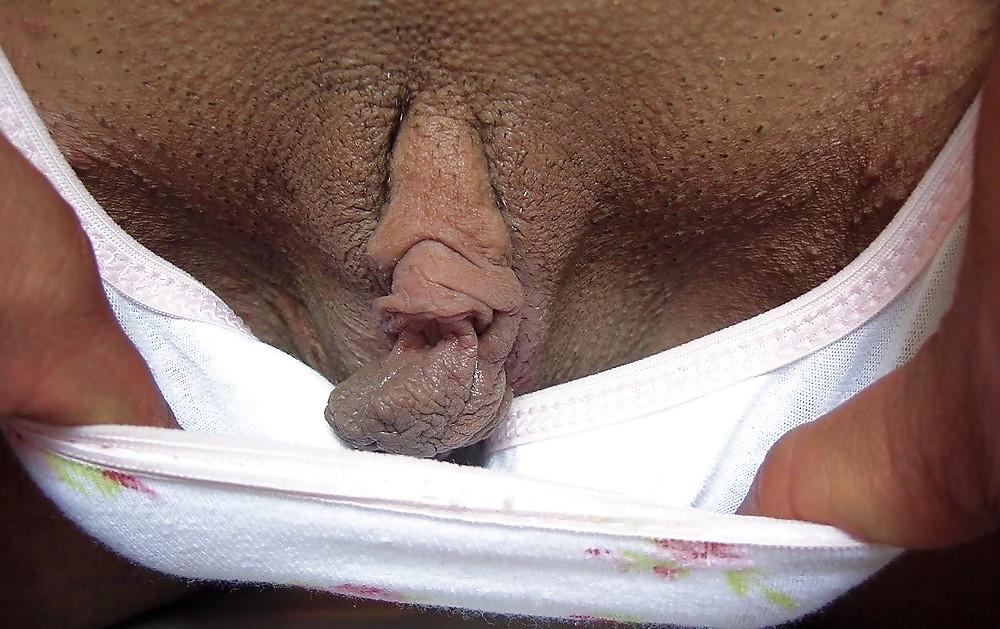 14P Gaping hole