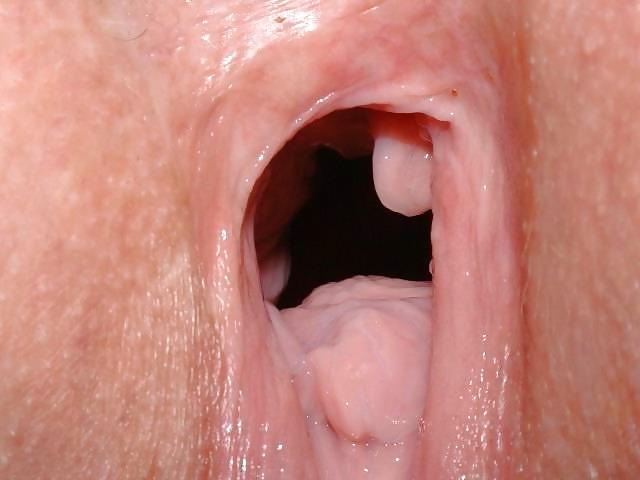 7P GAPE - 2