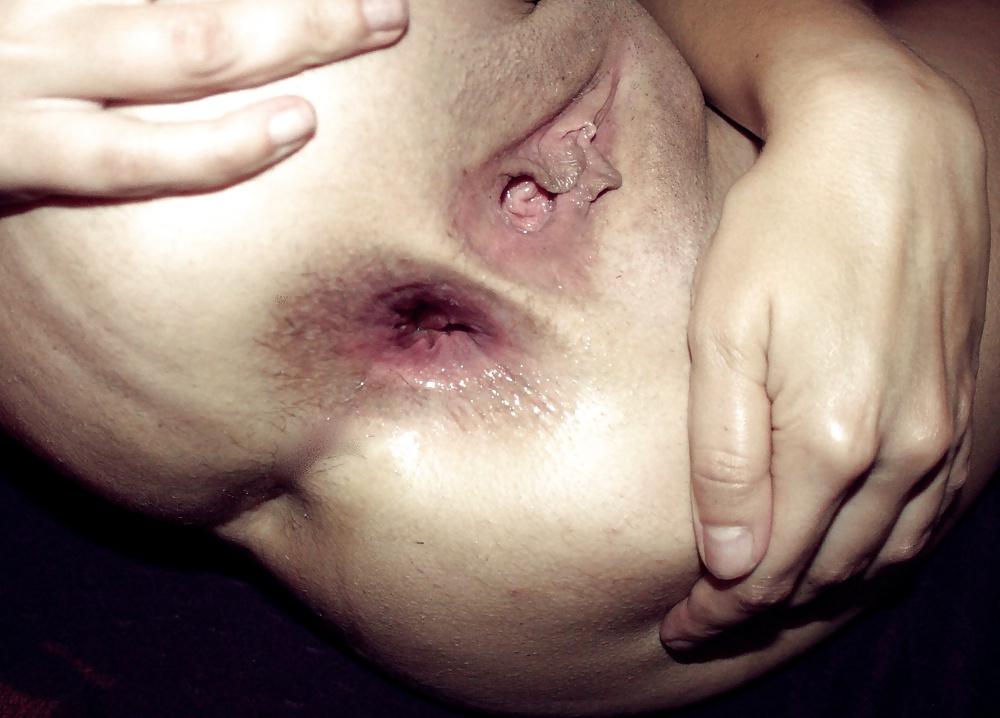 10P Ass hole gape 