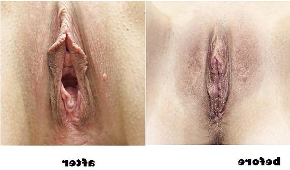 25P Pussy Gape