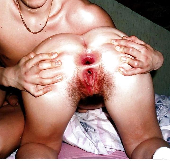 25P Open Ass Gape