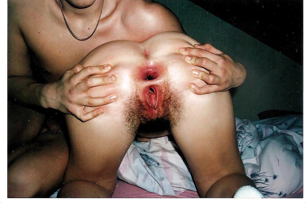 25P Open Ass Gape