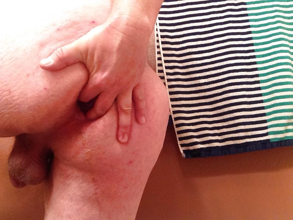 20P Gaping My Ass Hole