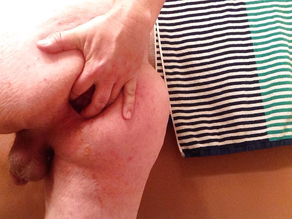 20P Gaping My Ass Hole