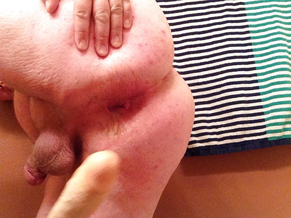 20P Gaping My Ass Hole