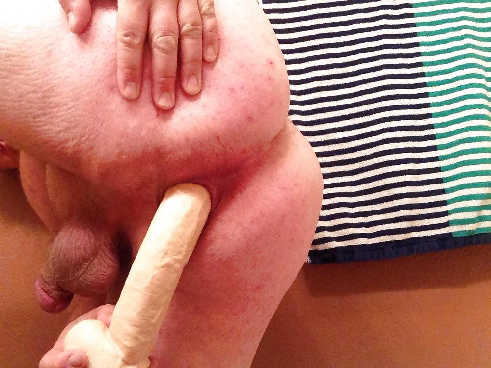 20P Gaping My Ass Hole