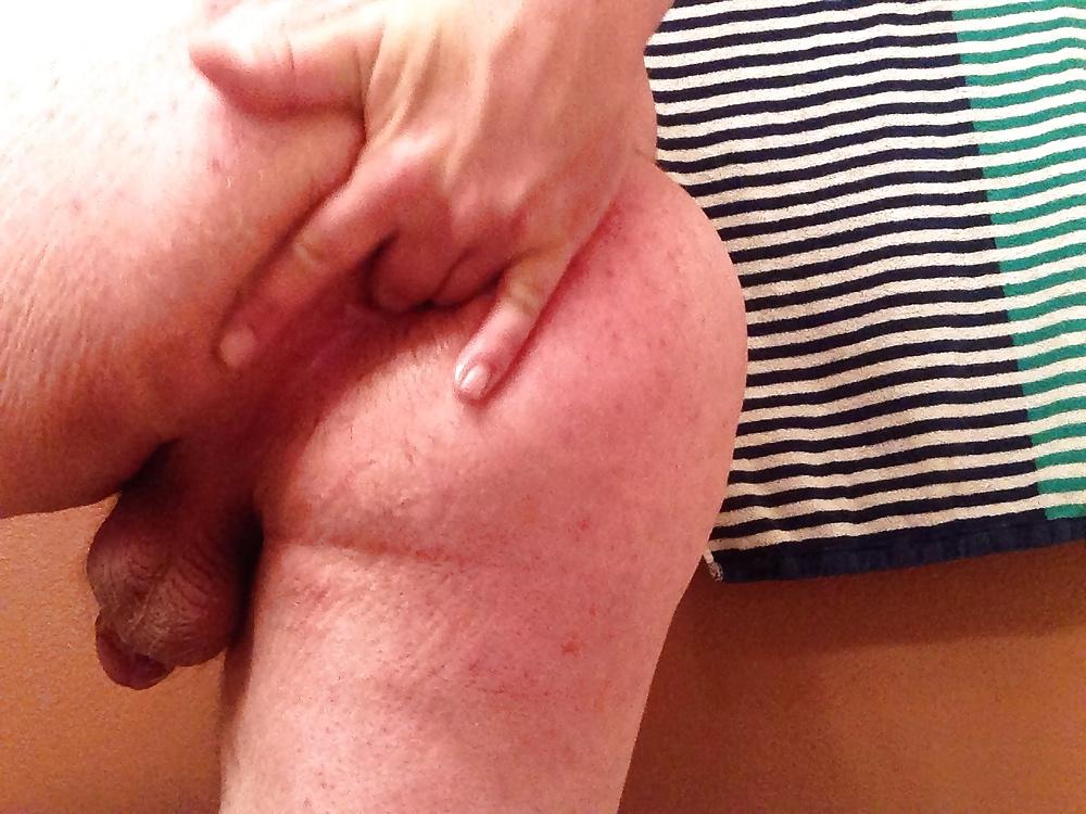 20P Gaping My Ass Hole