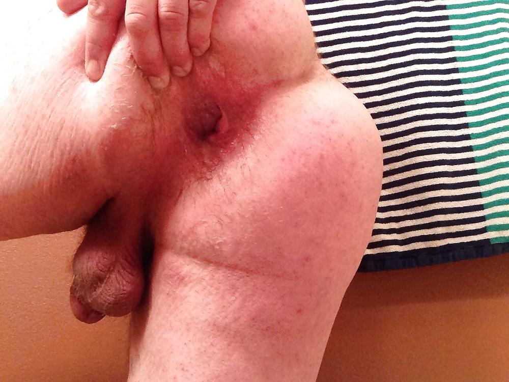 20P Gaping My Ass Hole