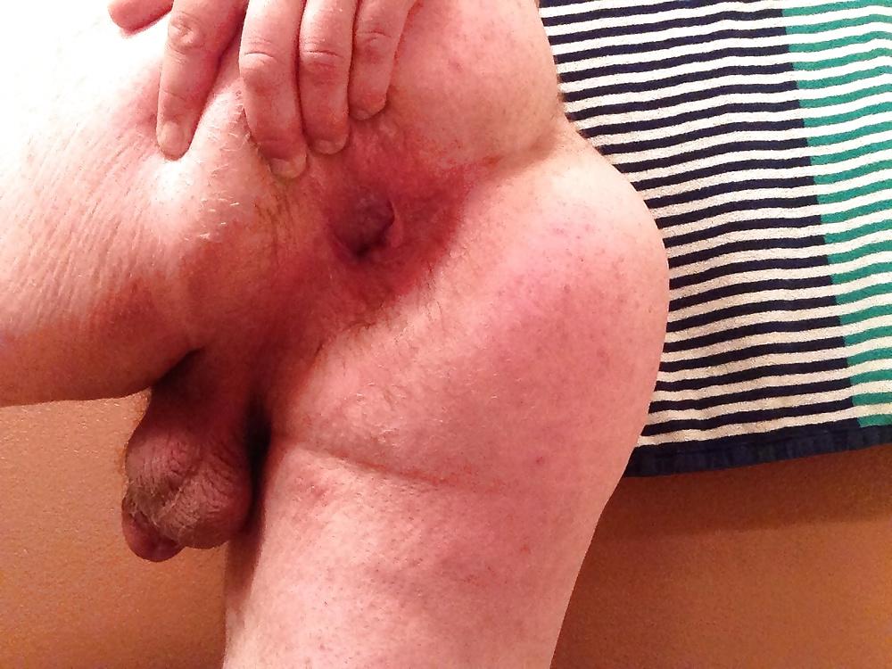 20P Gaping My Ass Hole