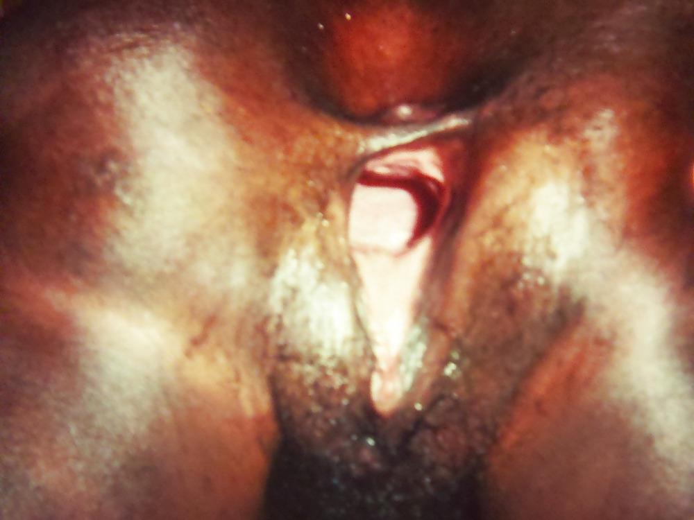 11P SEXY PUSSY GAPE