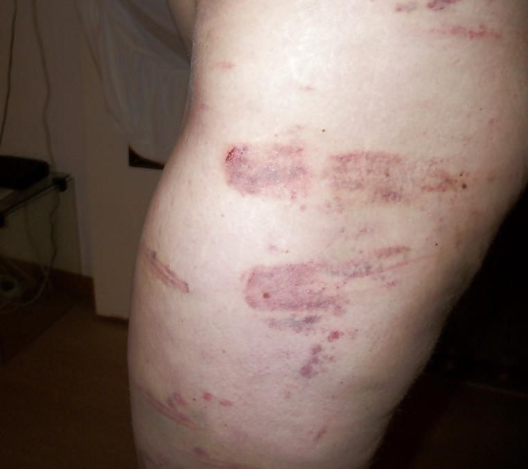 25P Slave 39 yo (severe used)