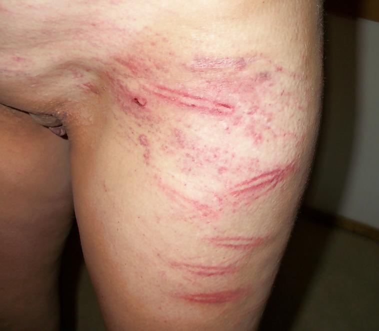 25P Slave 39 yo (severe used)