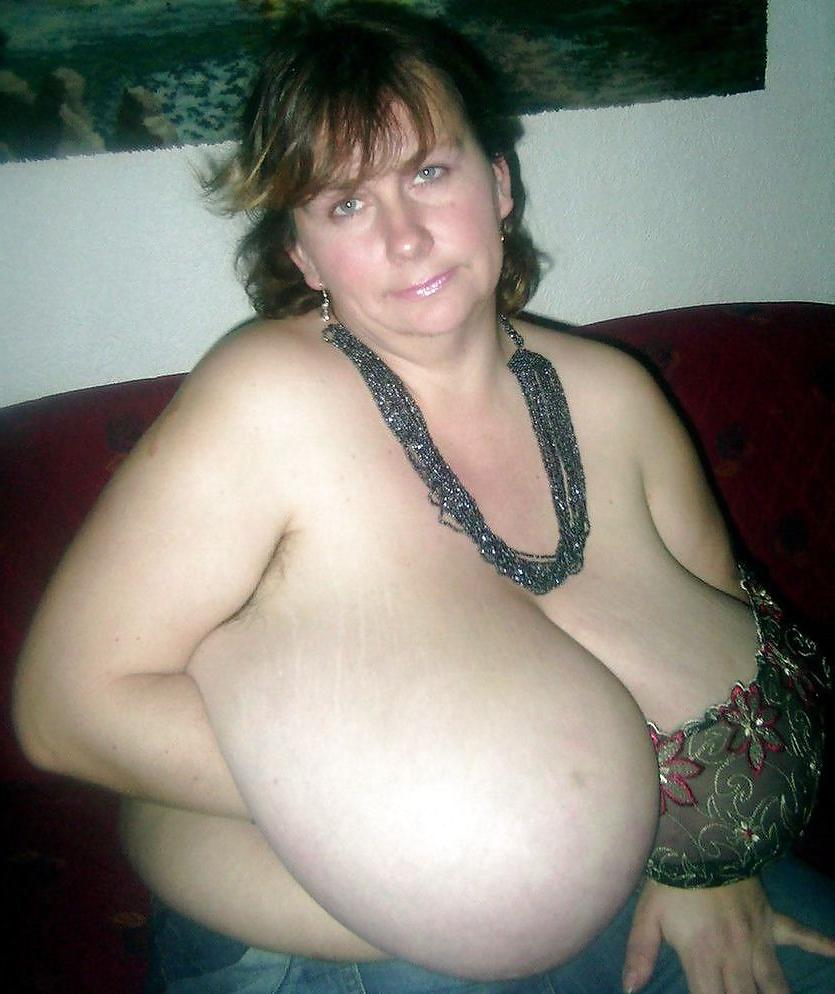 25P Big huge melons