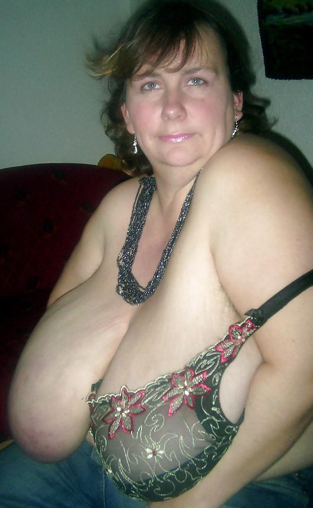 25P Big huge melons