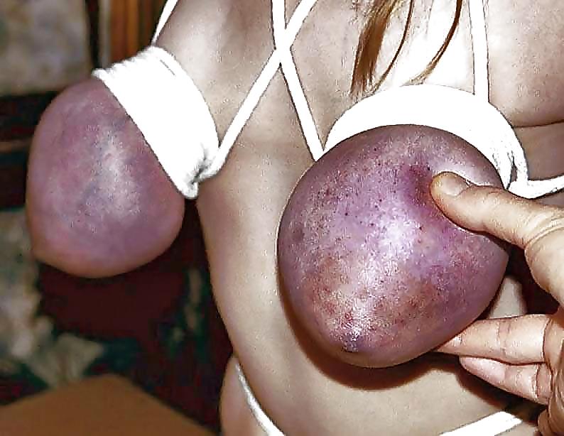 25P HUGE TITS 1