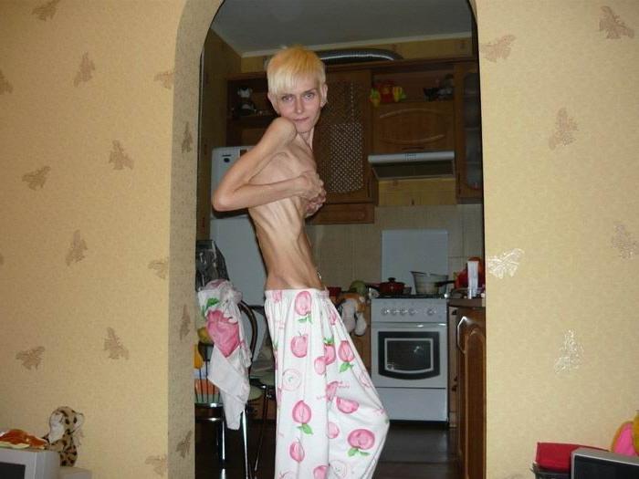 12P very skinny girls showing off their bones