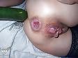 25P GAPE