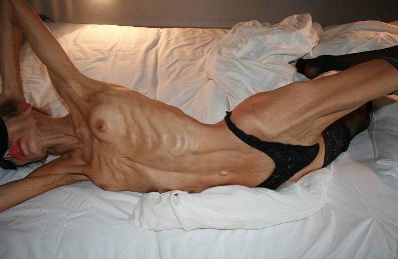 12P skinny anorexic girls showing off their bones