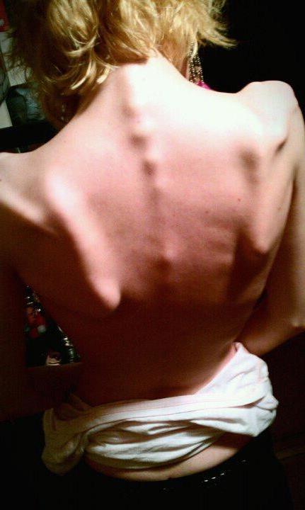15P Nude skinny girls with small tits