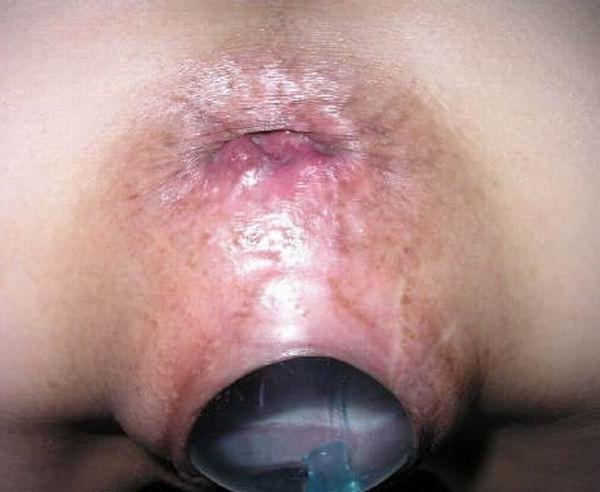 11P Weird porn pics
