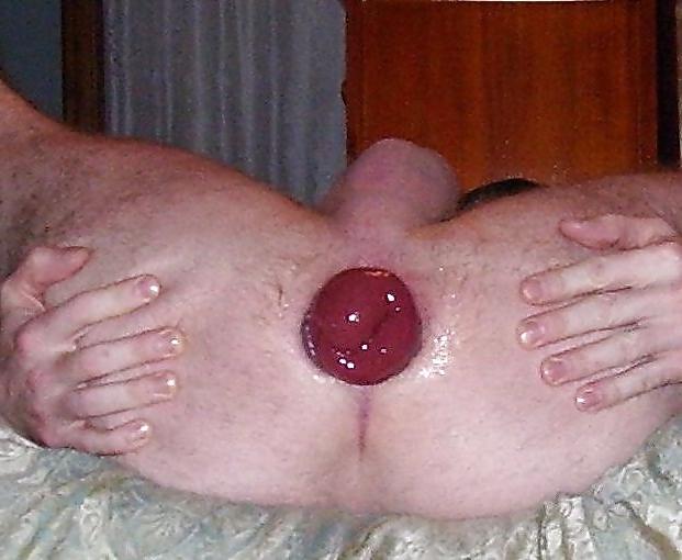 15P Prolapse and ass gape
