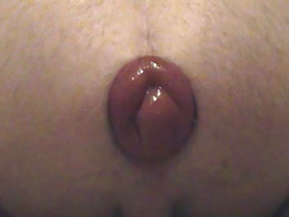 15P Prolapse and ass gape
