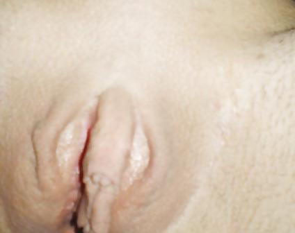 25P Huge Clits and Pussy Lips
