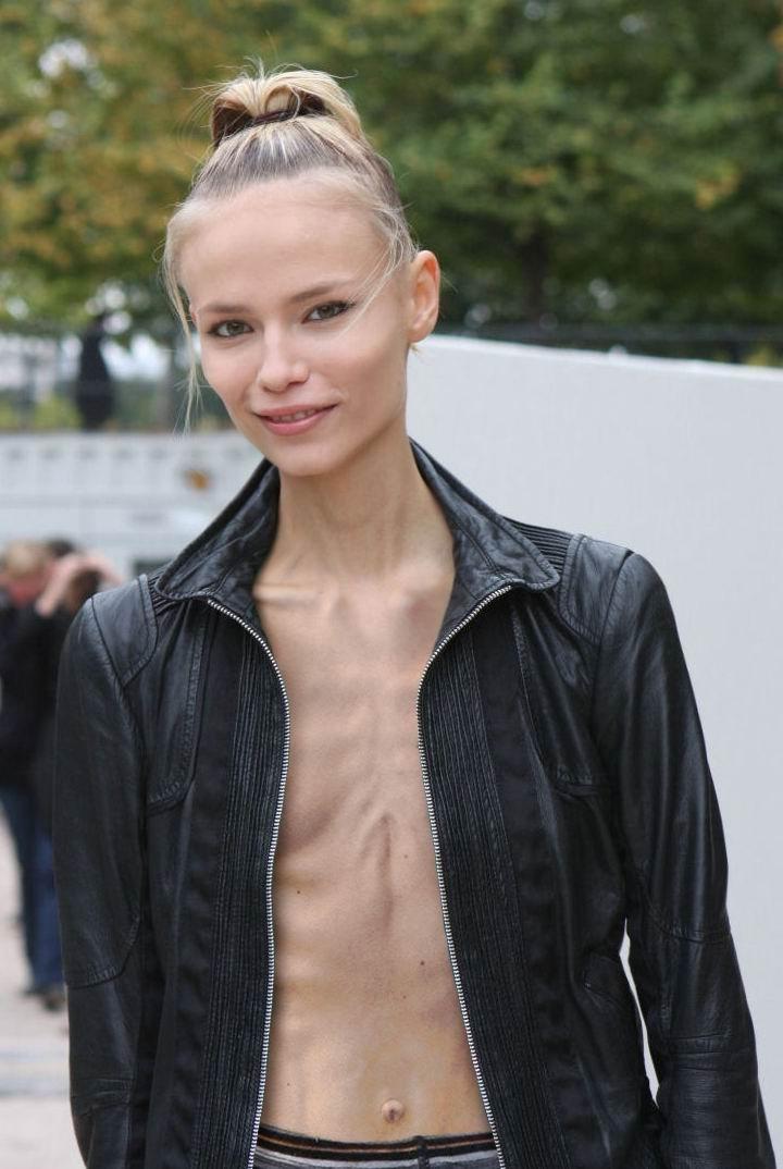 15P Slim and thin anorexic beauties