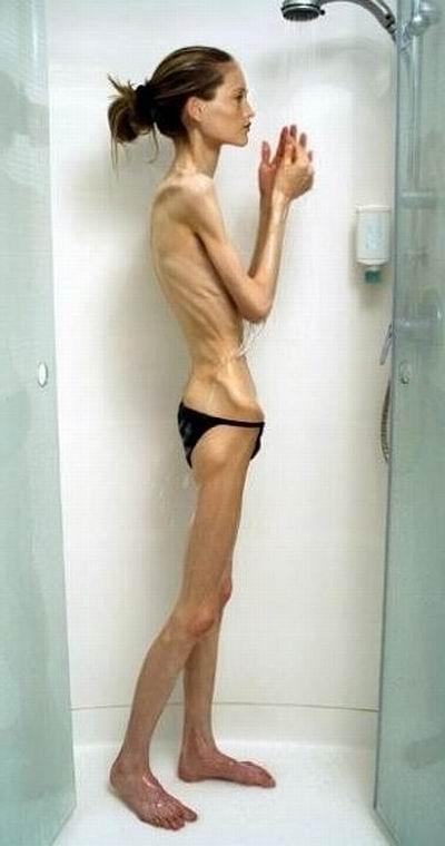 12P very skinny girls showing off their bones