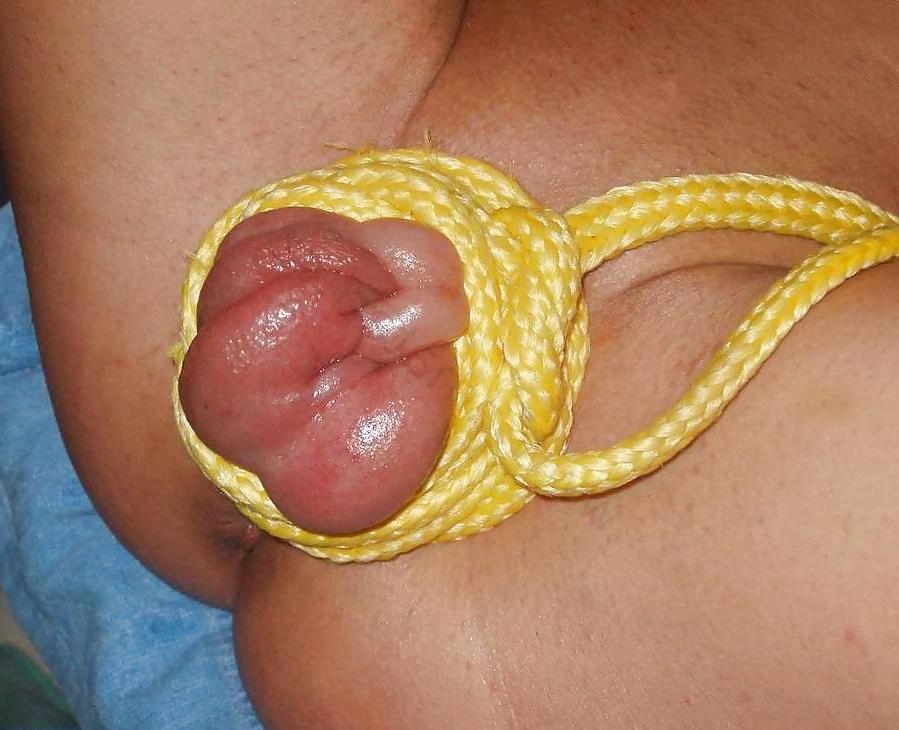25P Pumped pussy - best photos