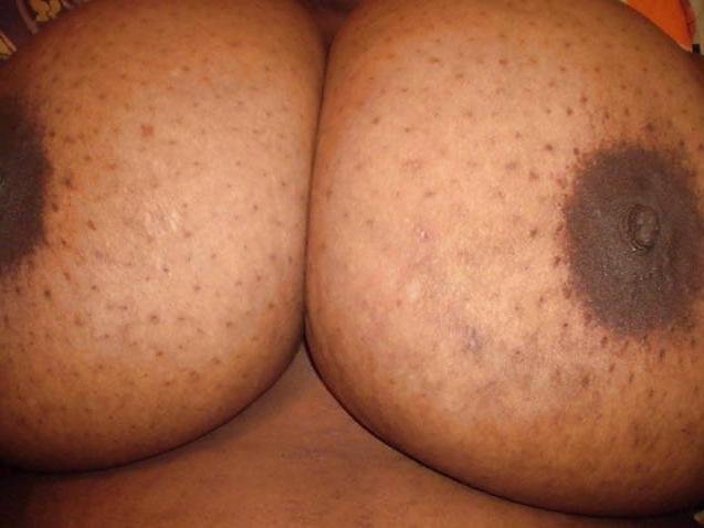 10P Huge Titts