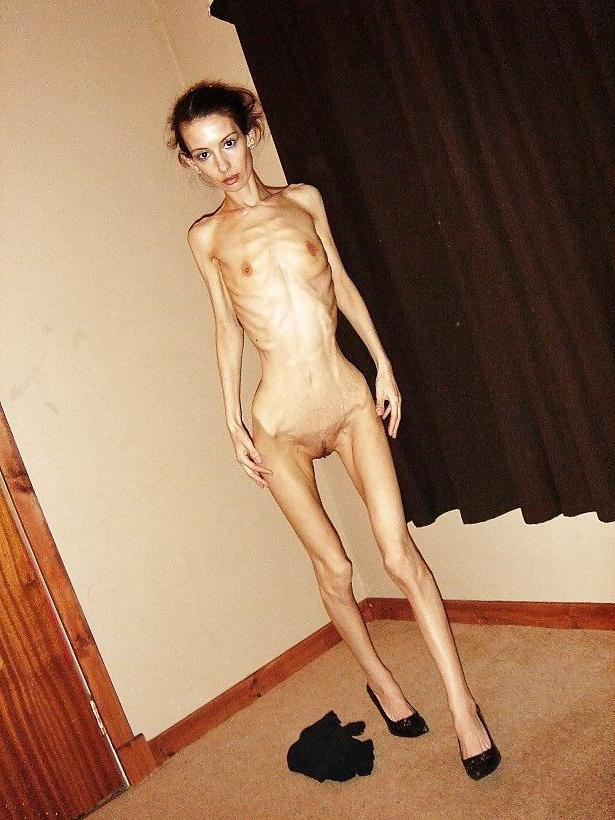 15P skinny anorexic girls posing and fucking