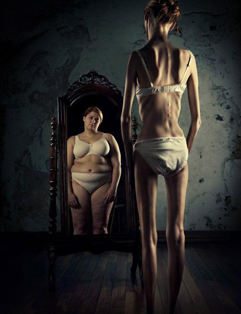 15P skinny girls showing off their anorexic bodies
