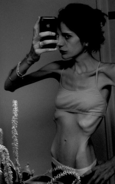 15P very skinny girls posing outdoors
