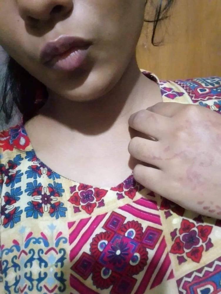 25P Huge Boob Bangladeshi Girl Leaked Nude Pic