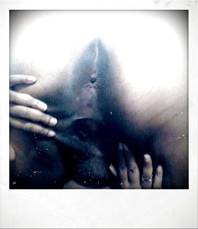10P Retro Cam Gape