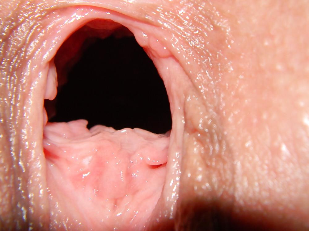 25P GAPE