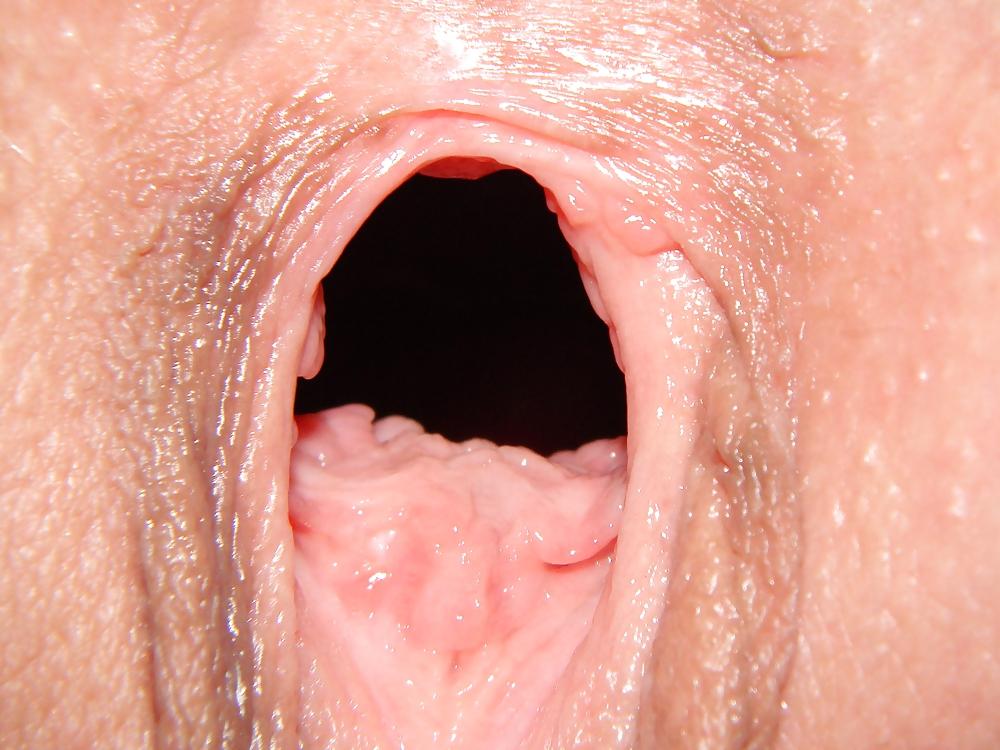 25P GAPE