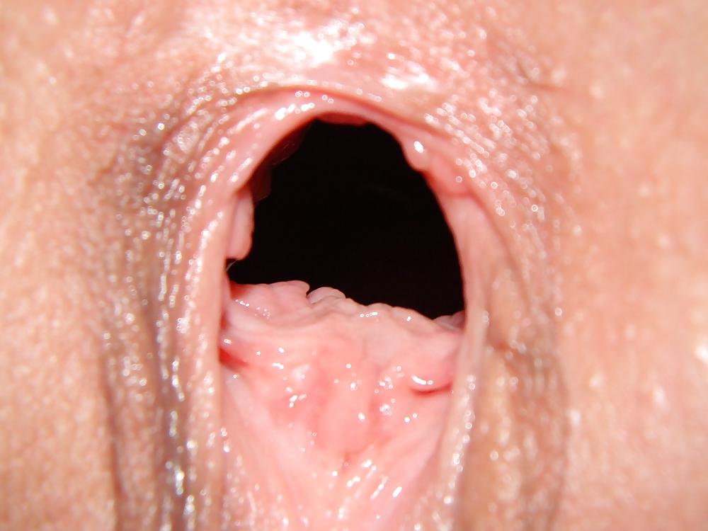 25P GAPE