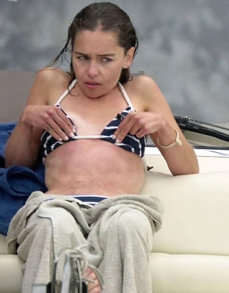 25P Emilia Clarke - from fatty to slim slut